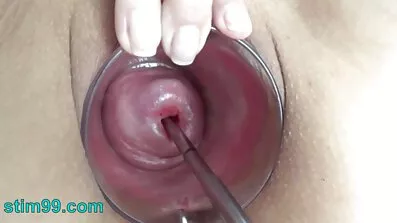 પેઢીનો મુકાબલો સેકસી વીડિયો બીપી પીચર